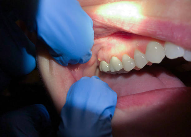 Best Root Canal Emergency Dentist  in Darien, IL